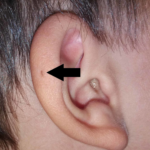 Gross Out the Gross Room: AKA - Win a Chance to be Featured in and Article or on TGR Podcast! lightbox_6de674c0a49a11eab4a29d4d13ace076-fig2-2-