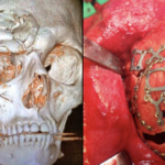 Take Me Out to the ER D Twitter