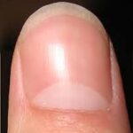 lunula-thumb